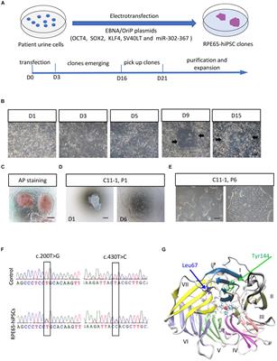 Generation and Characterization of Induced Pluripotent Stem Cells and Retinal Organoids From a Leber’s Congenital Amaurosis Patient With Novel RPE65 Mutations